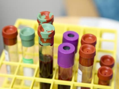 Жителей Самары и Тольятти приглашают на акцию в День доноров костного мозга