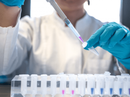 В Самарской области нашли виновных во вспышке поражающей печень инфекции