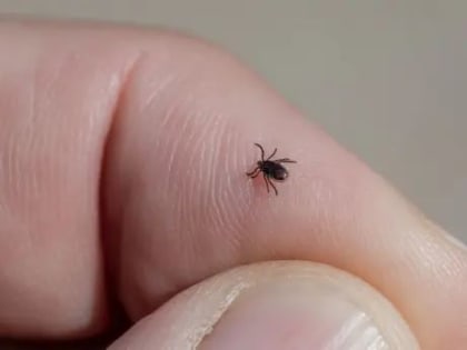 Инфекционисты оценили опасность поражающего людей нового вируса