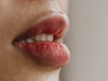 Косметолог рассказала, чем опасны филлеры с маркетплейсов