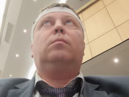 В Госдуме не признали депутата Матвеева с перебинтованной головой