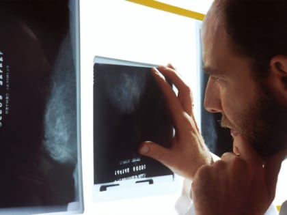 Онколог перечислил пять первых симптомов рака мозга