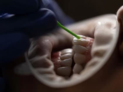 Самарский стоматолог объяснила, почему родители в ответе за здоровье зубов ребенка