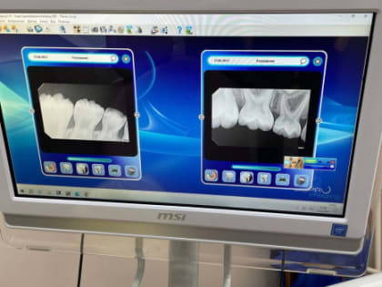 Самарский стоматолог Марина Воронина назвала симптомы, после которых нужно срочно бежать к врачу