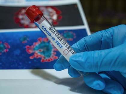 Медики все чаще закрывают по домам заболевших жителей Самарской области