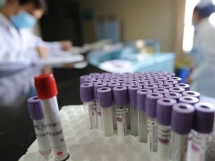 В Оренбуржье начали регистрировать первые случаи заражения гриппом А