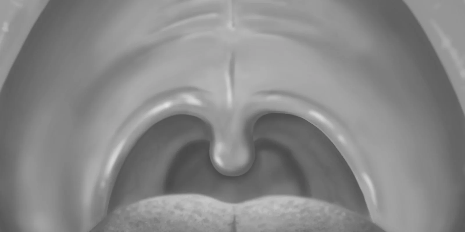 hpv az uvula kezelésen