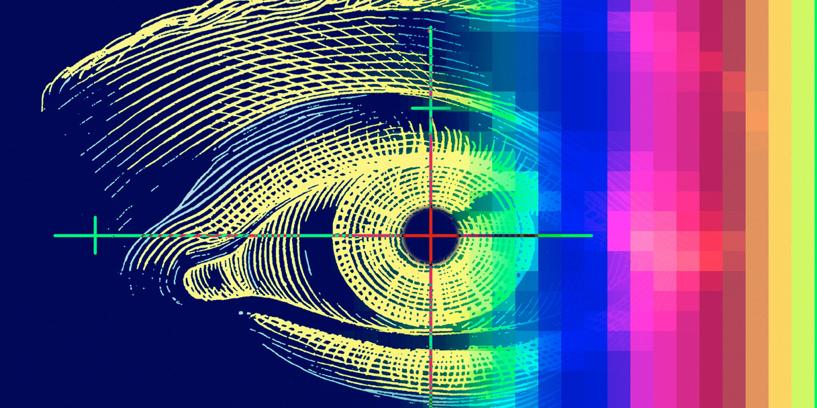 ARVO 2019: Protocol V Clinical Trial Supports Observational Approach to DME