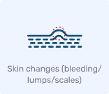 cancer_skin_changes