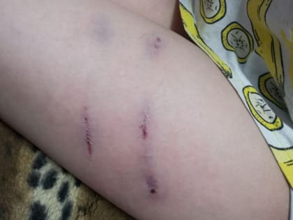 Томский следком изучает два случая с нападением бродячих собак на детей