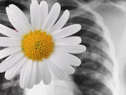 6 вещей, которые надо знать о туберкулезе!