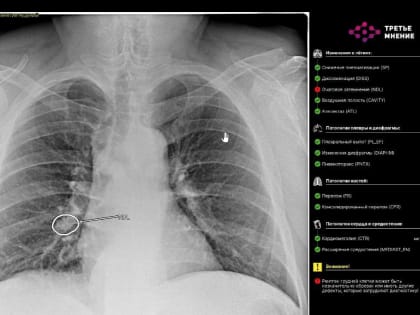 Технологии в помощь: «Ростелеком» автоматизировал лучевую диагностику в здравоохранении Томской области