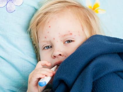 Омский Роспотребнадзор предупредил о риске появления в регионе кори