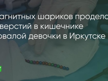 Иркутские хирурги спасли малышку, проглотившую больше десятка магнитных шариков