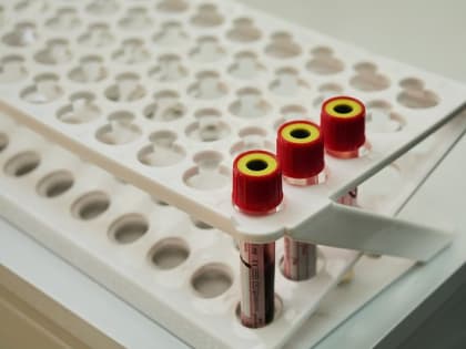 За сутки в Иркутской области зарегистрировано 158 случаев COVID-19