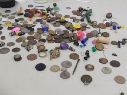 Красноярские медики рассказали о коллекции проглоченных детьми предметов