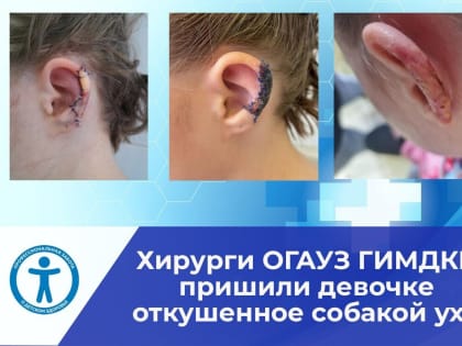Ампутированную часть уха пришили школьнице врачи оториноларингологи Ивано-Матренинской детской клинической больницы
