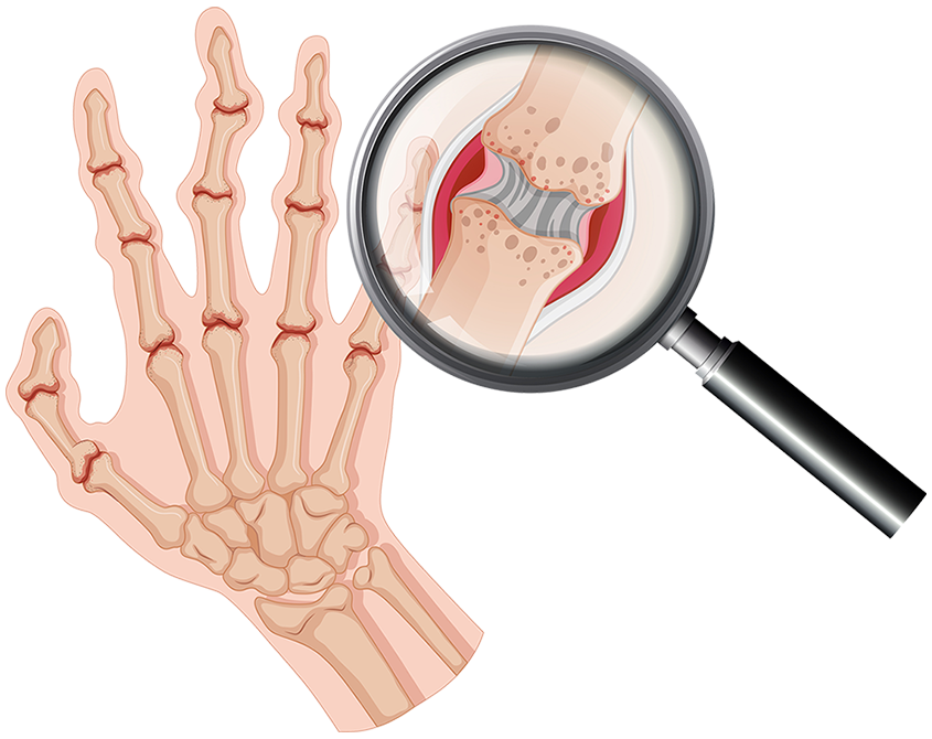 Rheumatology