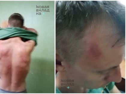 «Новая вкладка»: неизвестные пытали подозреваемого в поджоге буквы Z в Белгороде