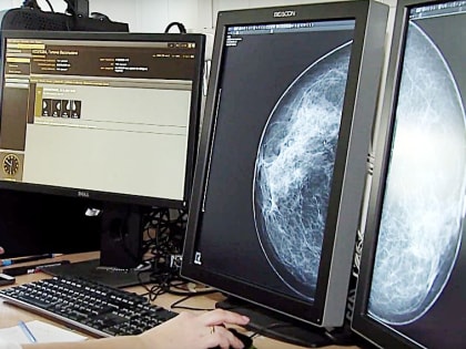 Советы врача: онколог из Белгорода ответила на вопросы о раке груди