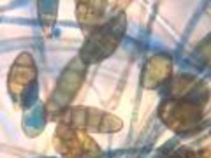 Диагносты Белгородской испытательной лаборатории обнаружили возбудителя нозематоза в подморе пчел