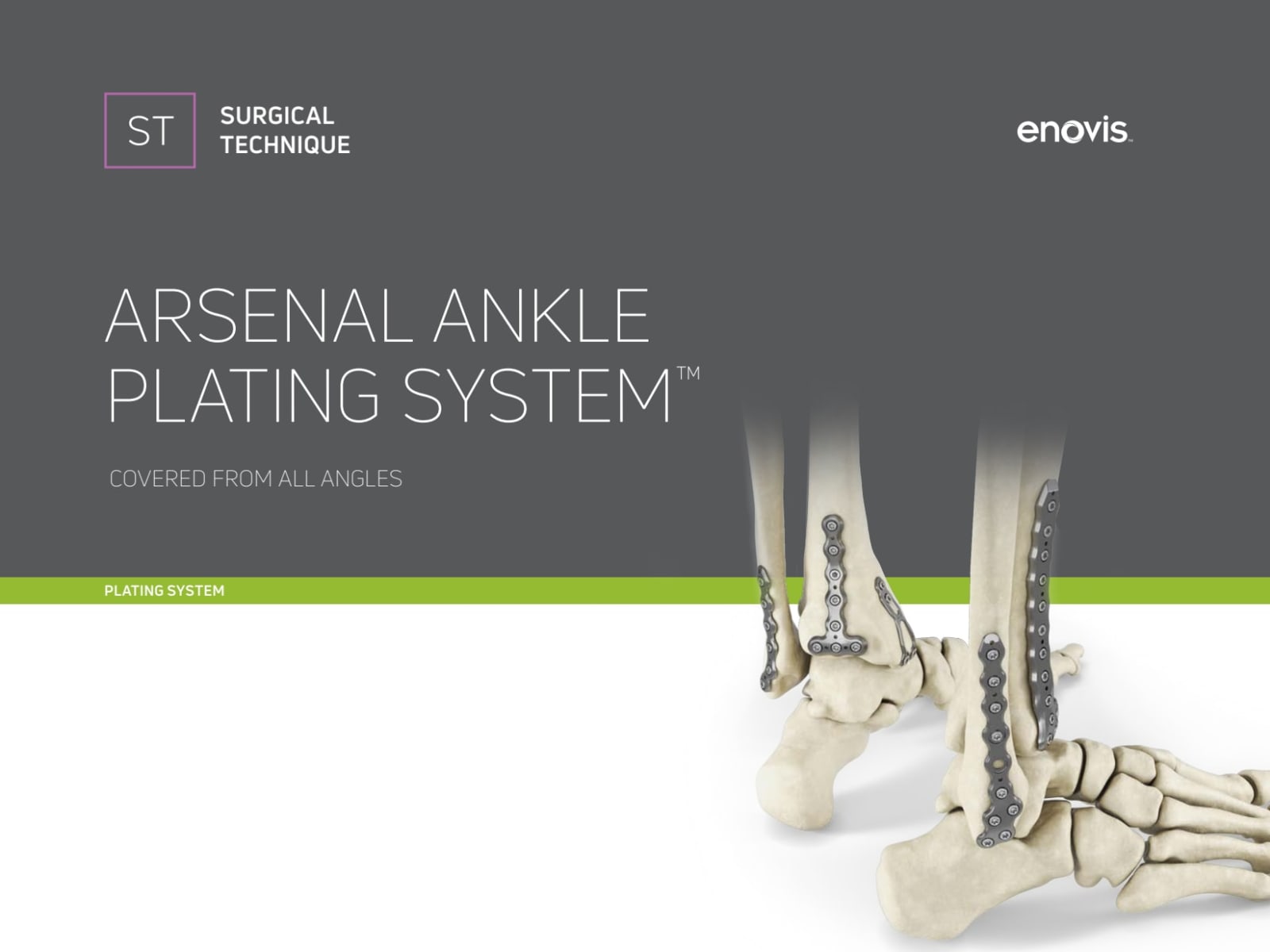 Arsenal Ankle Fracture Surgical Technique