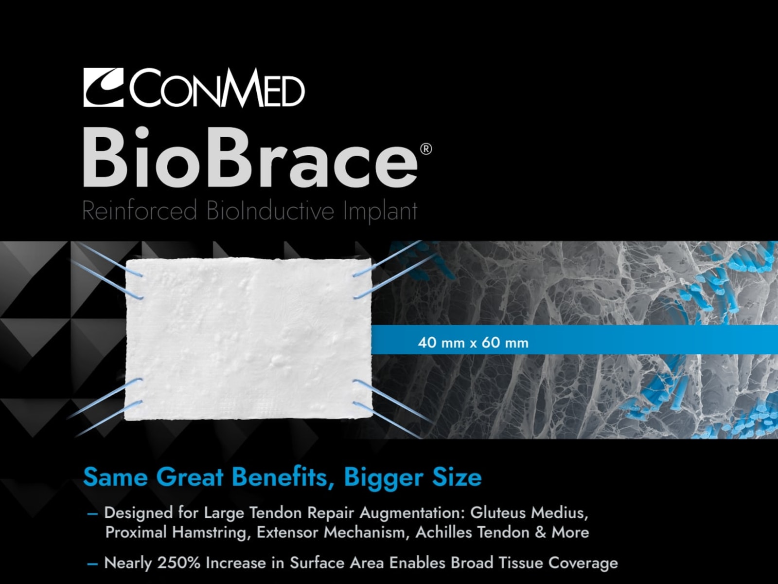 BioBrace Product Snapshot 40x60