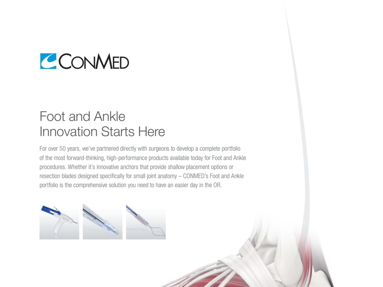 ConMed Foot Ankle Solutions Product Brochure