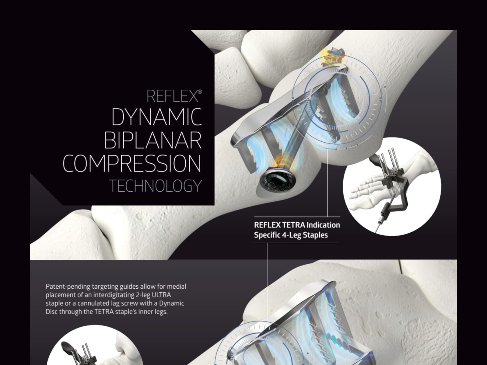 MEDLINEUNITE® Reflex Tetra Product Sheet