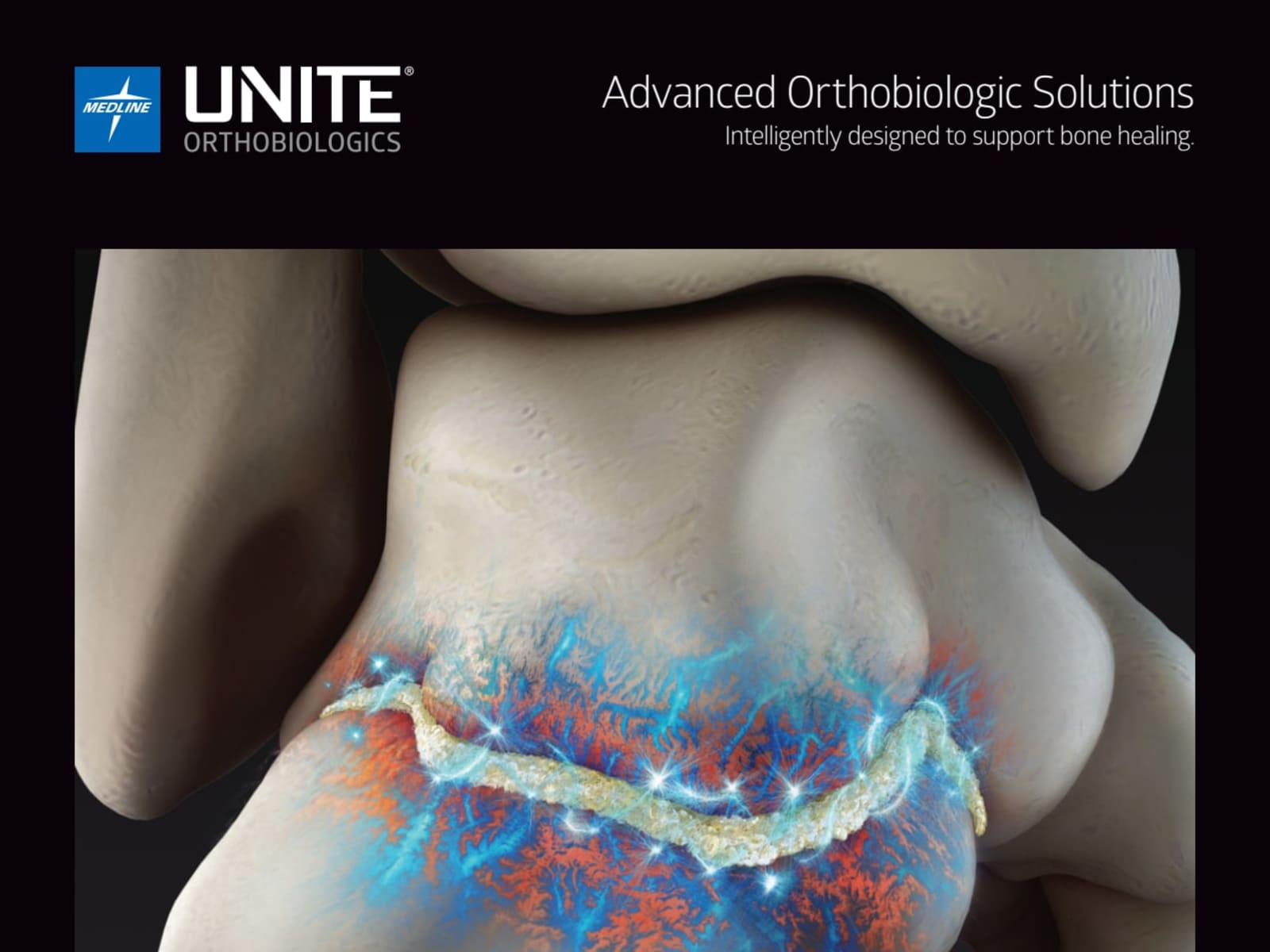 Medline Unite Brochure Advanced Orthobiologic Solutions