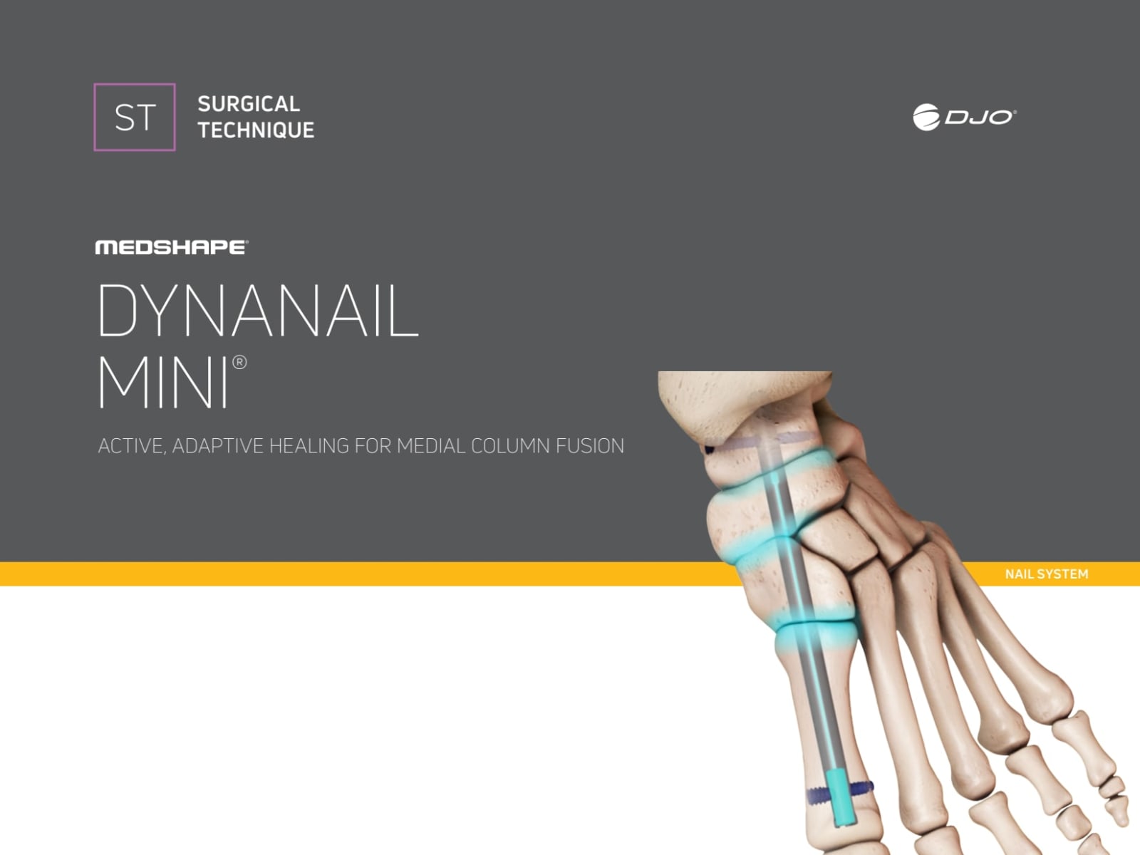 Mini Medial Column Surgical Technique