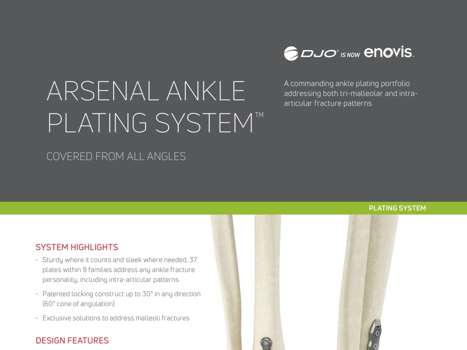 Overview - Arsenal Ankle Fracture