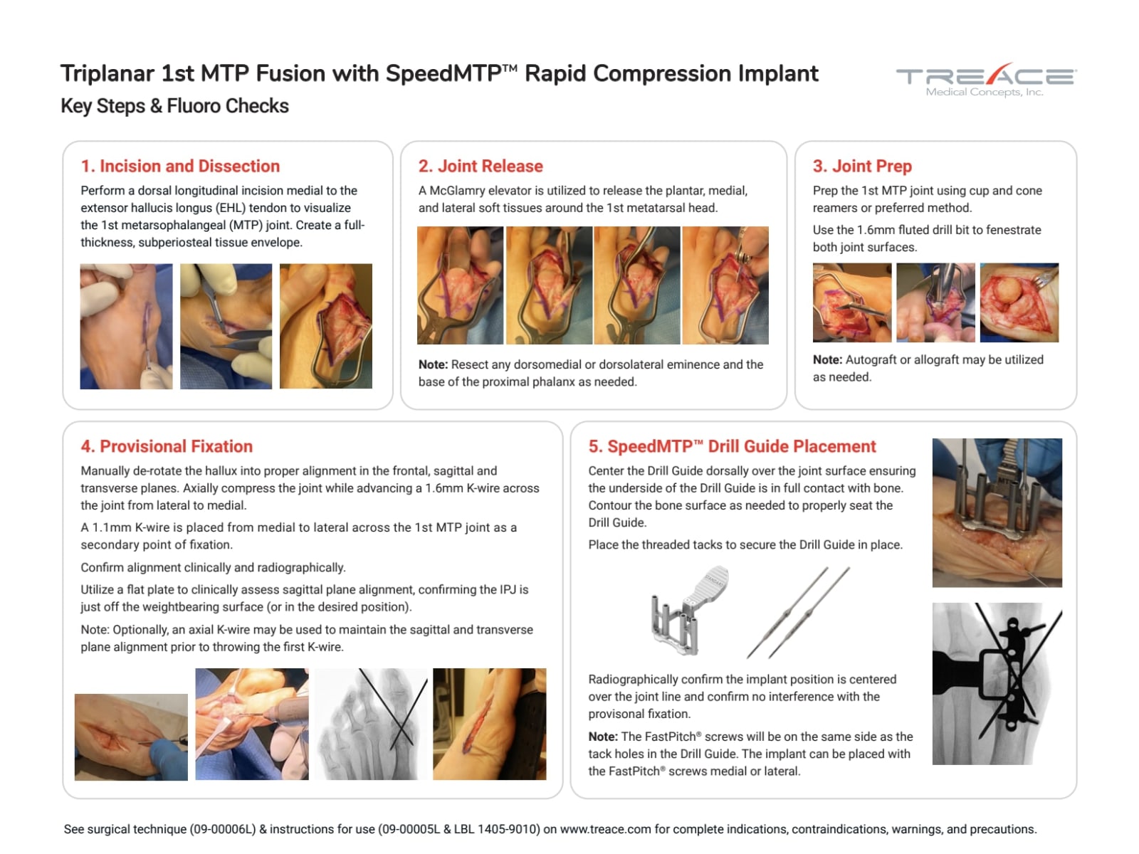 SpeedMTP Key Steps
