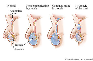 Small Testis