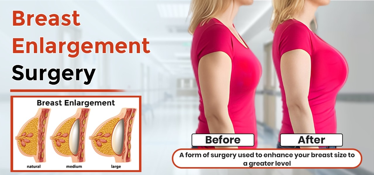 Best Breast Enlargement Surgery In Jalandhar, #1