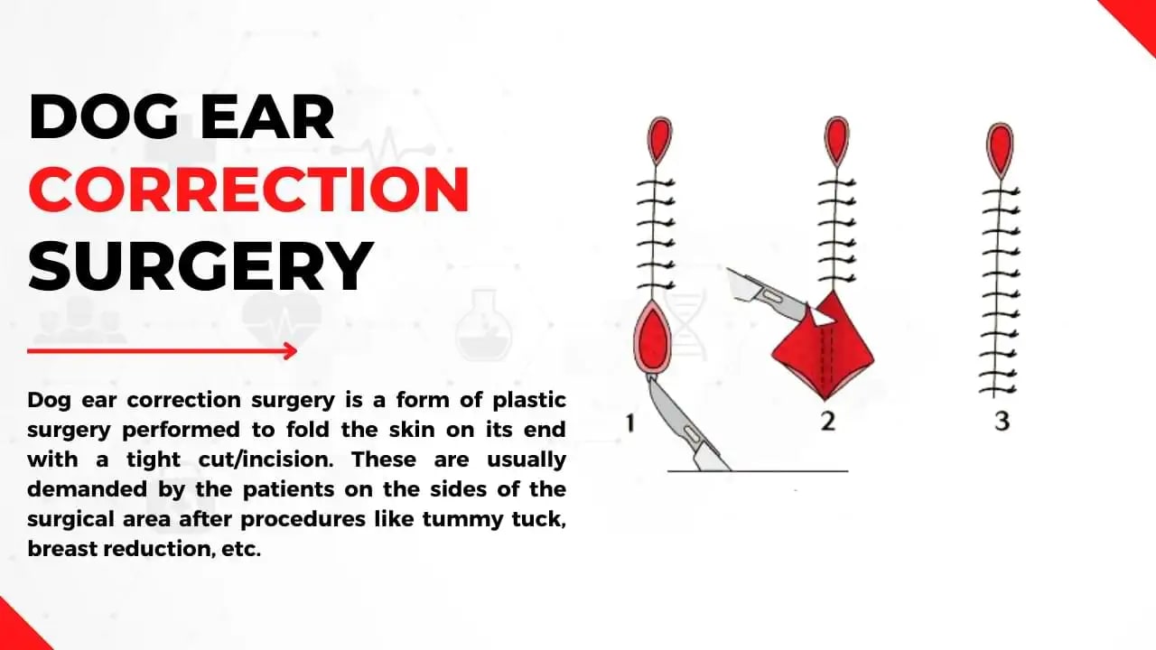 Dog Ear Correction Surgery In India No.1 Scar Repair Treatment