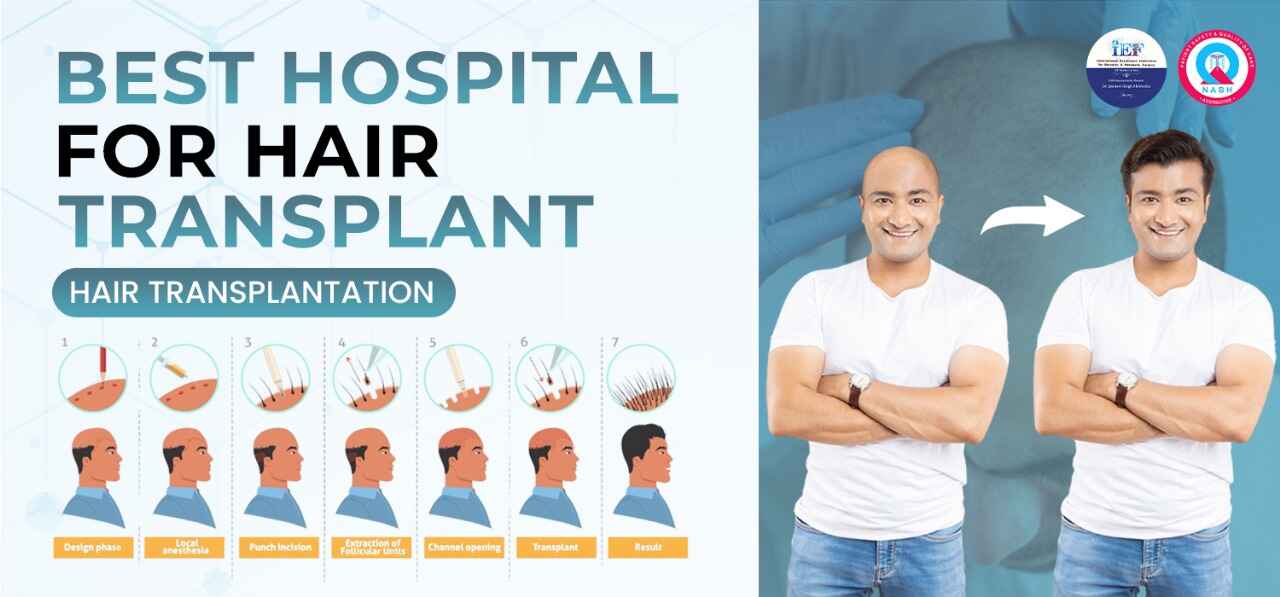 Hair Transplant Surgery in Jalandhar Hair Transplant Clinic