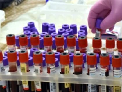 Роспотребнадзор нашёл ряд нарушений в детском лагере Евпатории