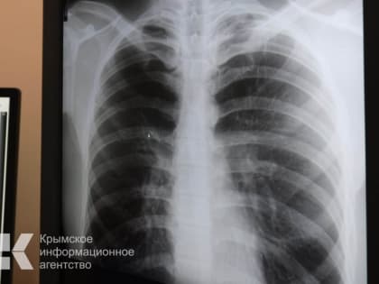 В Джанкое судебные приставы доставили больную туберкулёзом на принудительное лечение