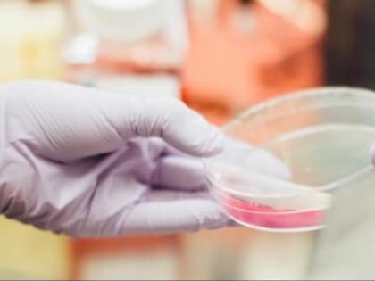 В Крыму стали чаще болеть псориазом: причины и методы борьбы