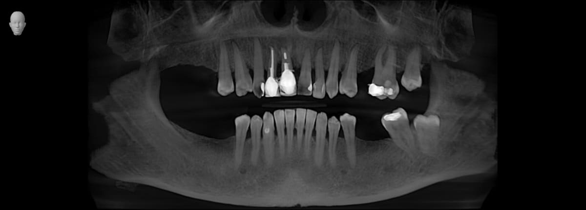 PL_VO1_Panorama_2025-05-14_14_44