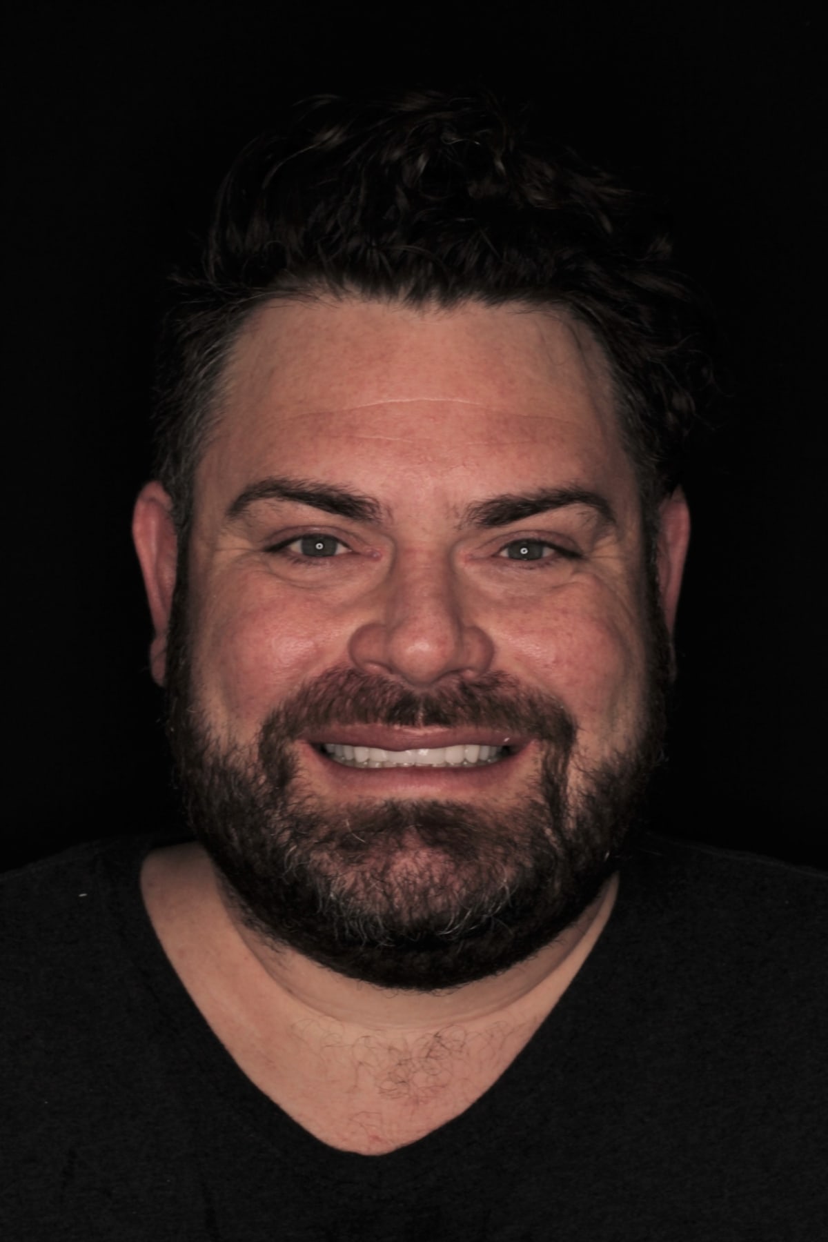 Full face portrait of the patient smiling after upper implant rehabilitation