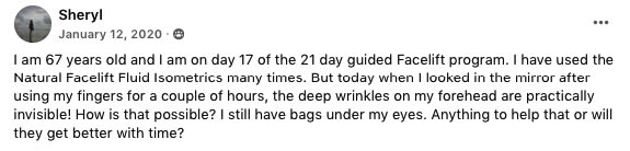 Sheryl - Facelift - Aging