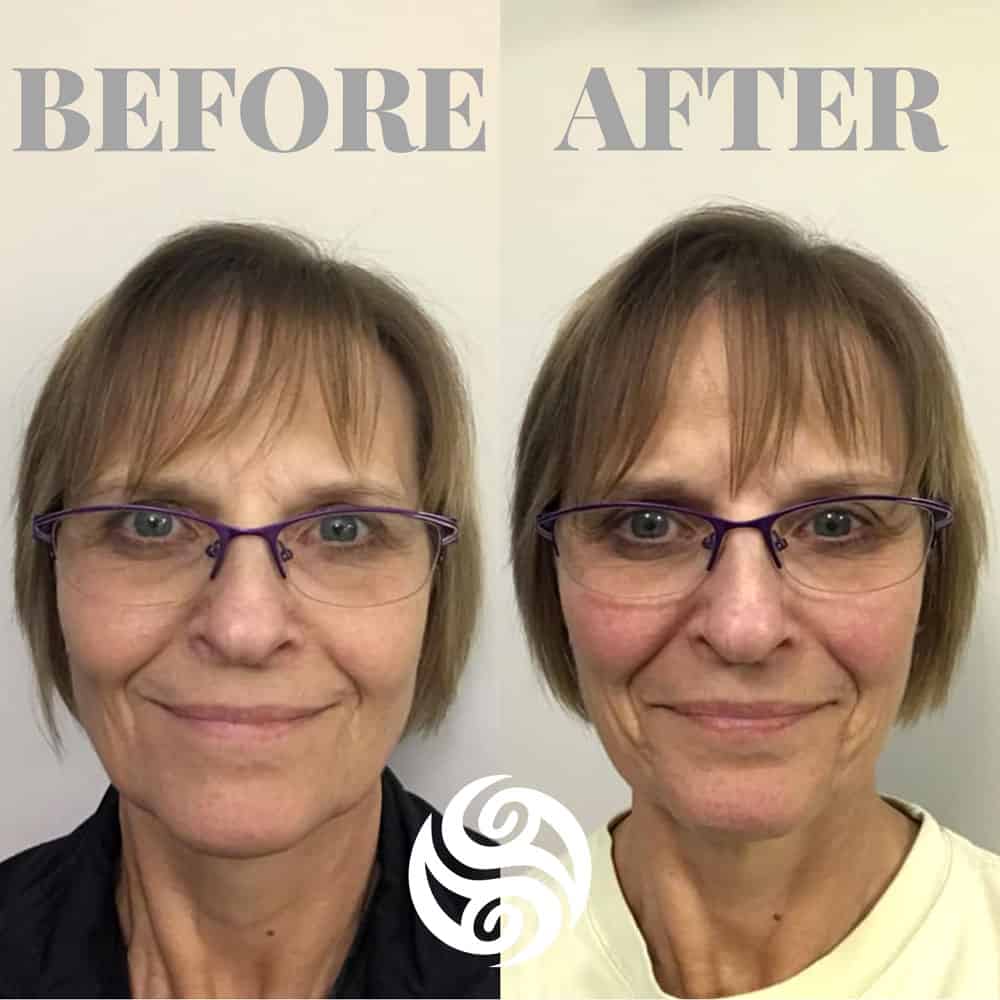 Tammy-Before-and-After