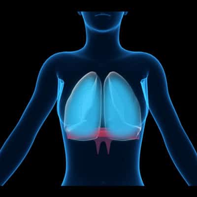 Inflate-Space-Square