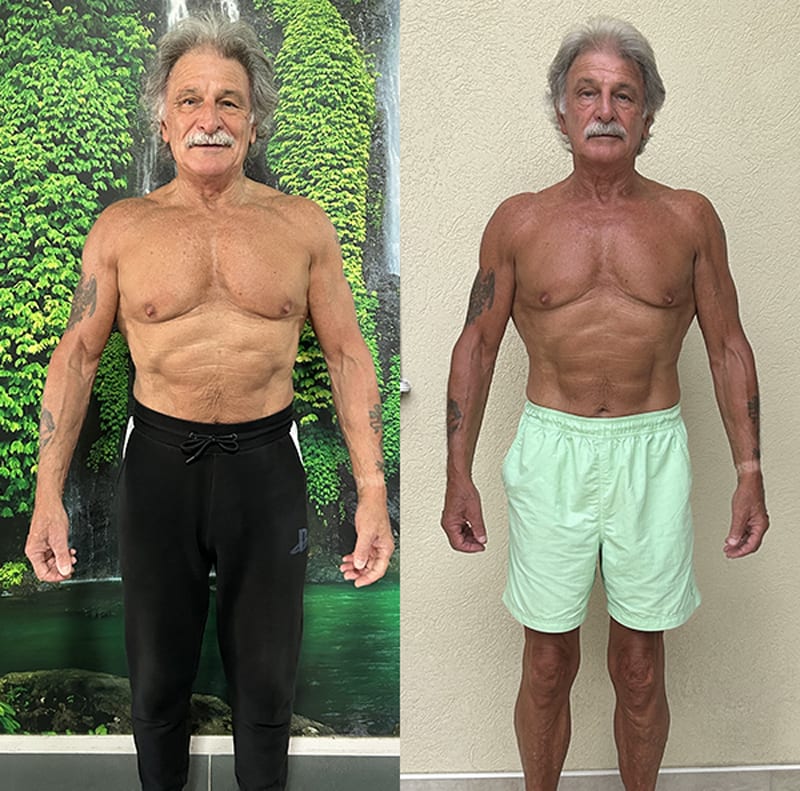 Walter-Before-After