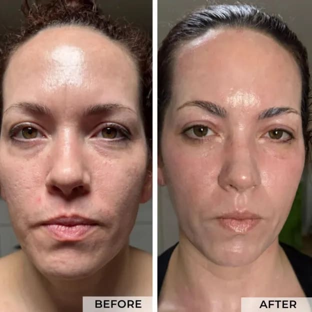 Facial-Flow-BA-A_0001_Layer-2-NOWM