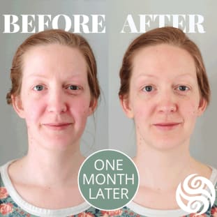 Erin Before and after