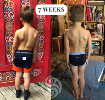 Zenon-Before-&-After