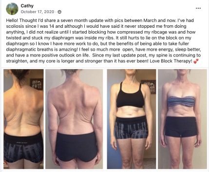 Cathy - Scoliosis copy
